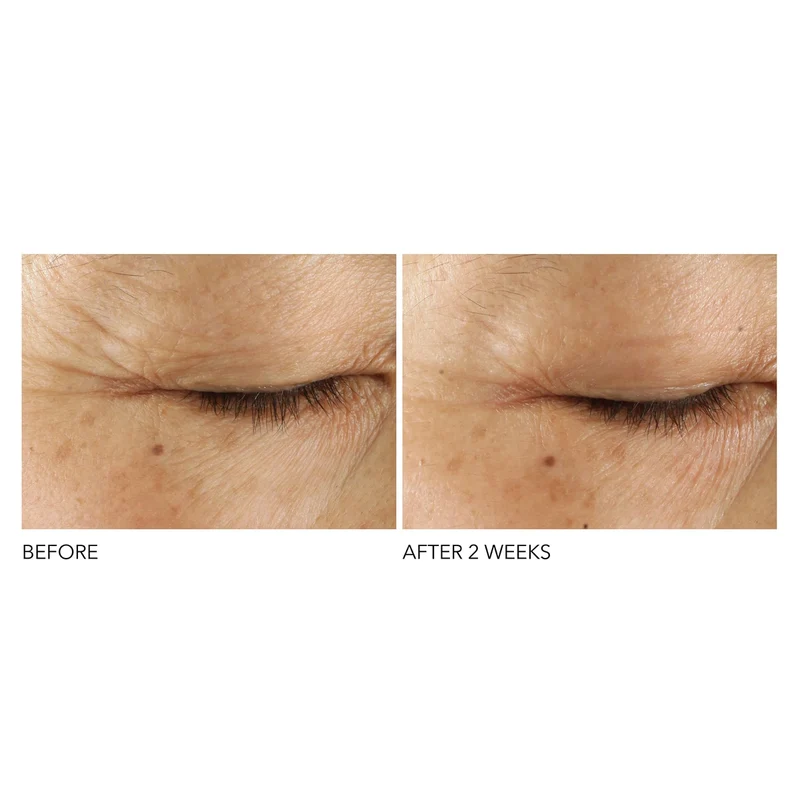 Triple Correction Eye Serum