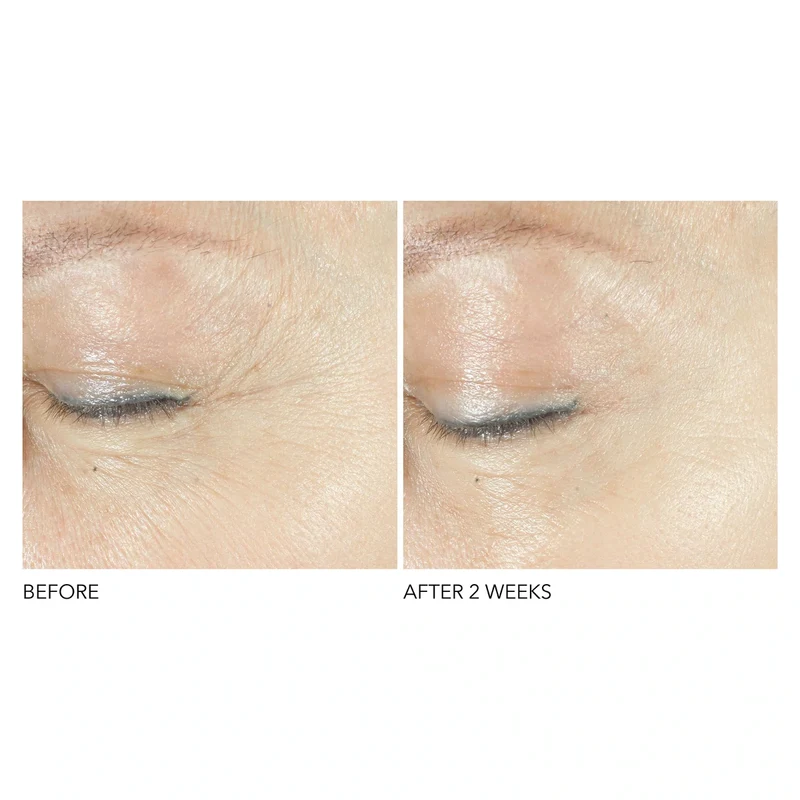 Triple Correction Eye Serum
