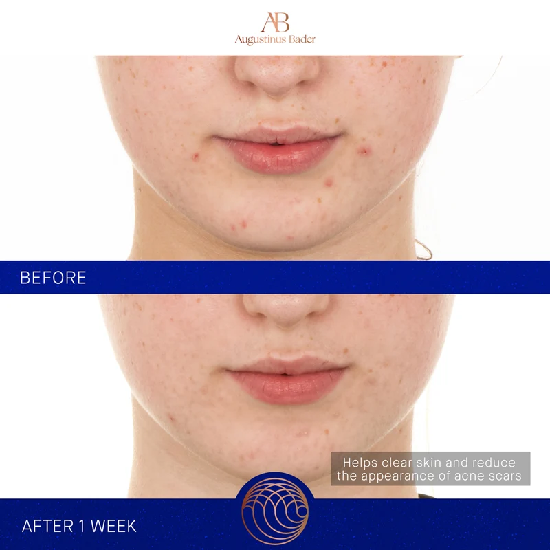 The Retinol Serum