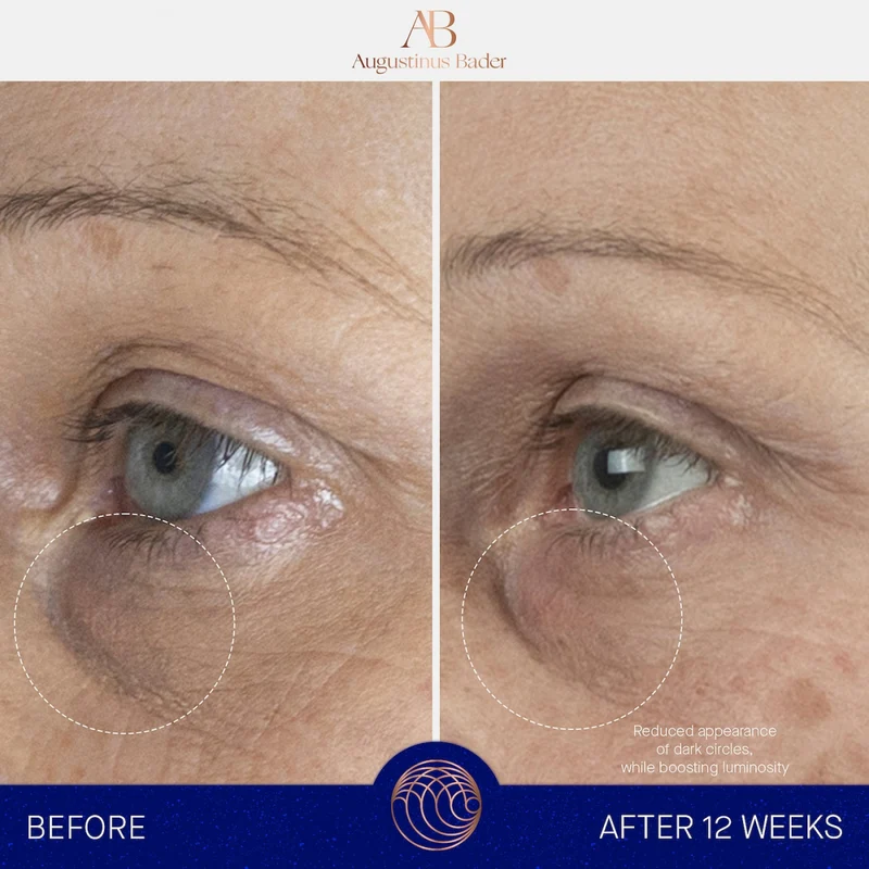 The Eye Cream Nomad Refill