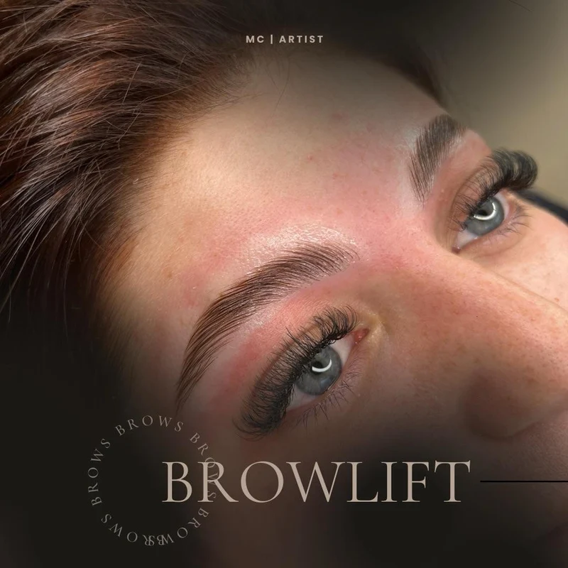 KIT BROW LIFT