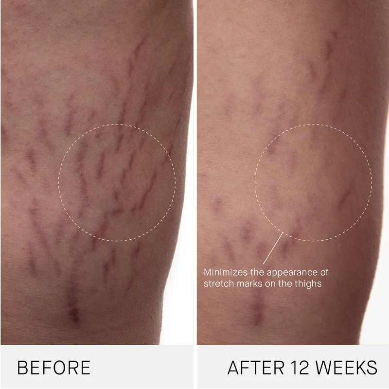 The Body Cream