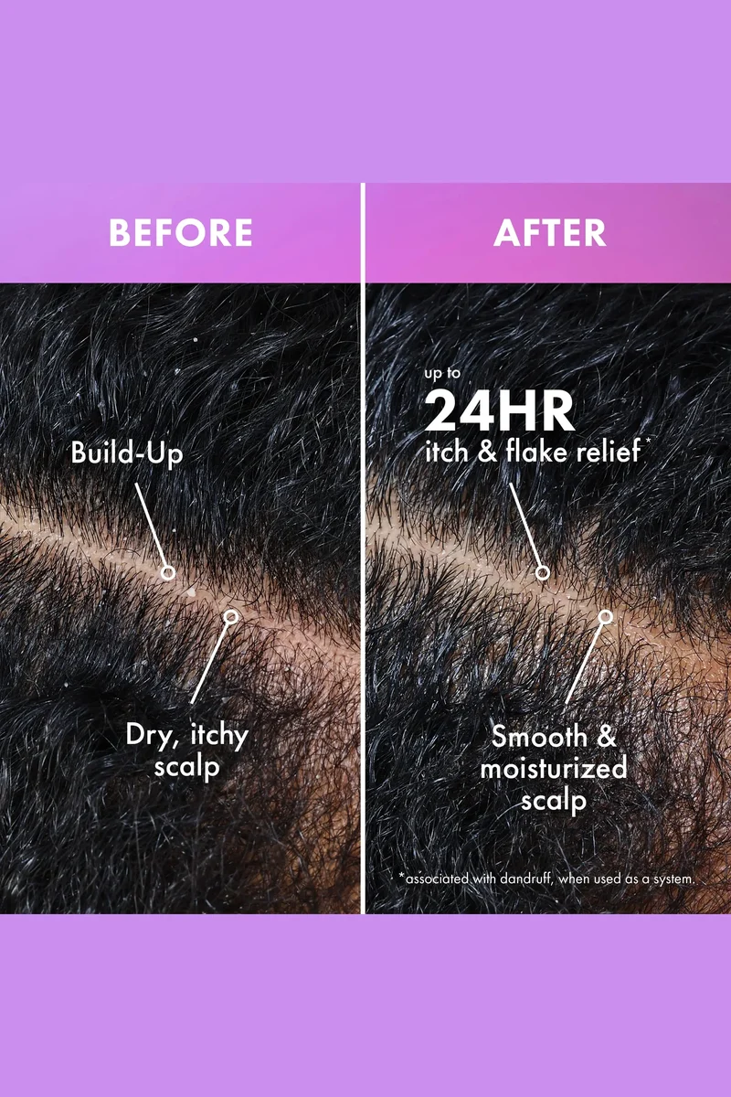 MIELLE LAVENDER & LYCHEE DAILY SCALP MOISTURIZING LOTION