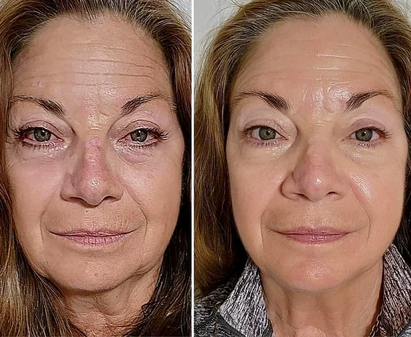 Huile de beauté anti-âge ÉTHER ARTIST