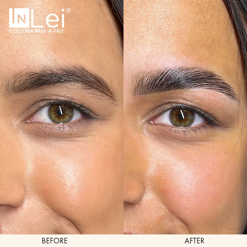 InLei® "Brow Lift 1"