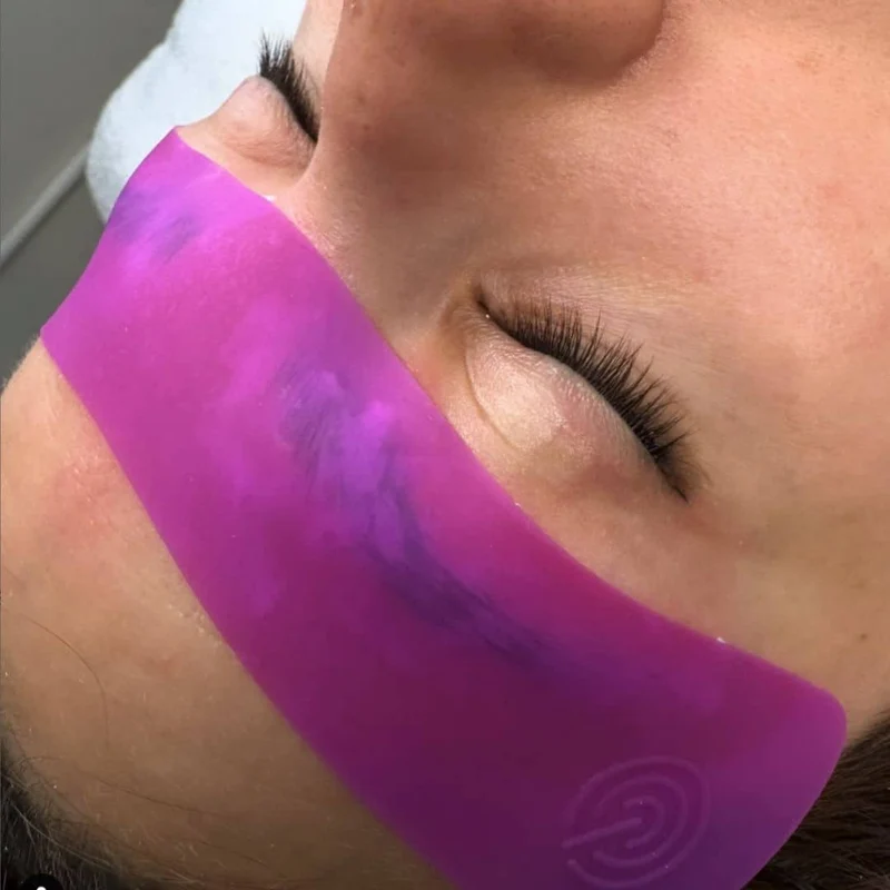 Brow Patch Maxymova pour Brow Lift