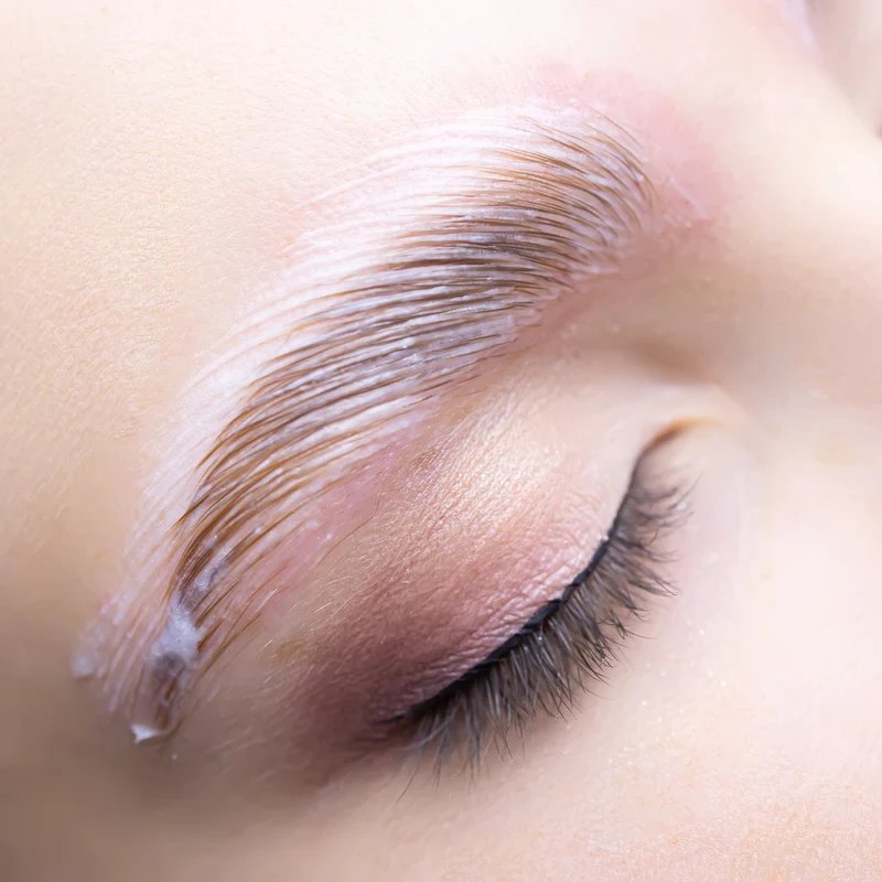 Film Brow Lift