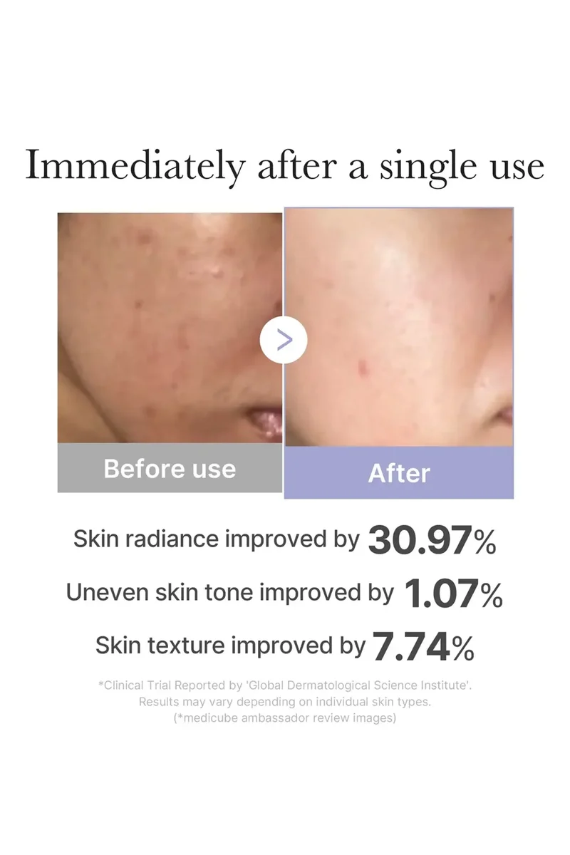 MEDICUBE AGE-R BOOSTER PRO MINI – PORTABLE LED SKIN BOOSTING DEVICE