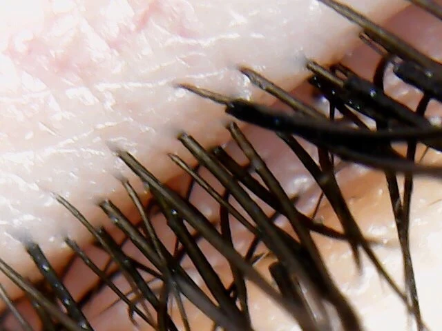 Lash Health Checker