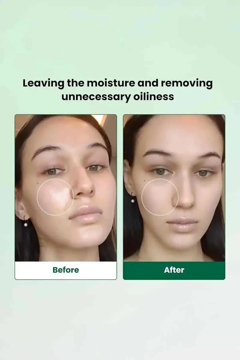 DR.G RED BLEMISH OIL CONTROL PAPER - BEST BLOTTING PAPER FOR OILY SKIN & T ZONE OIL