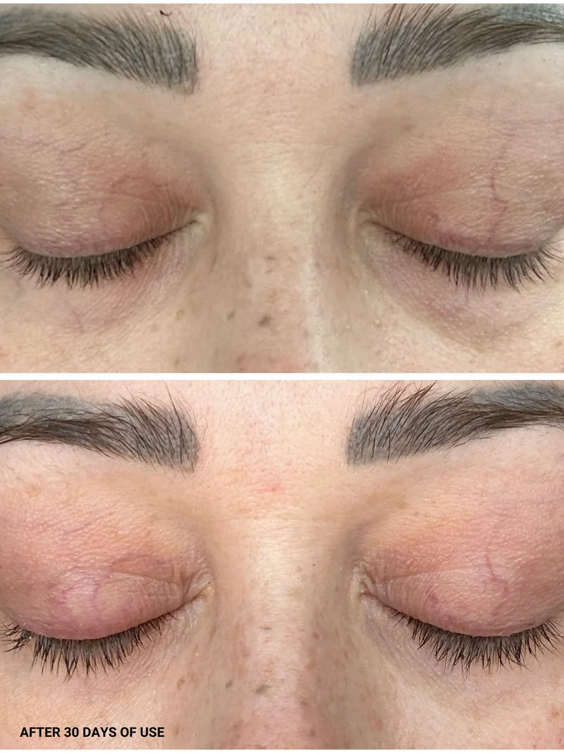 Eyelash Serum