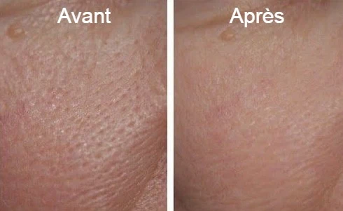 Base ultra-lissante ARTIST