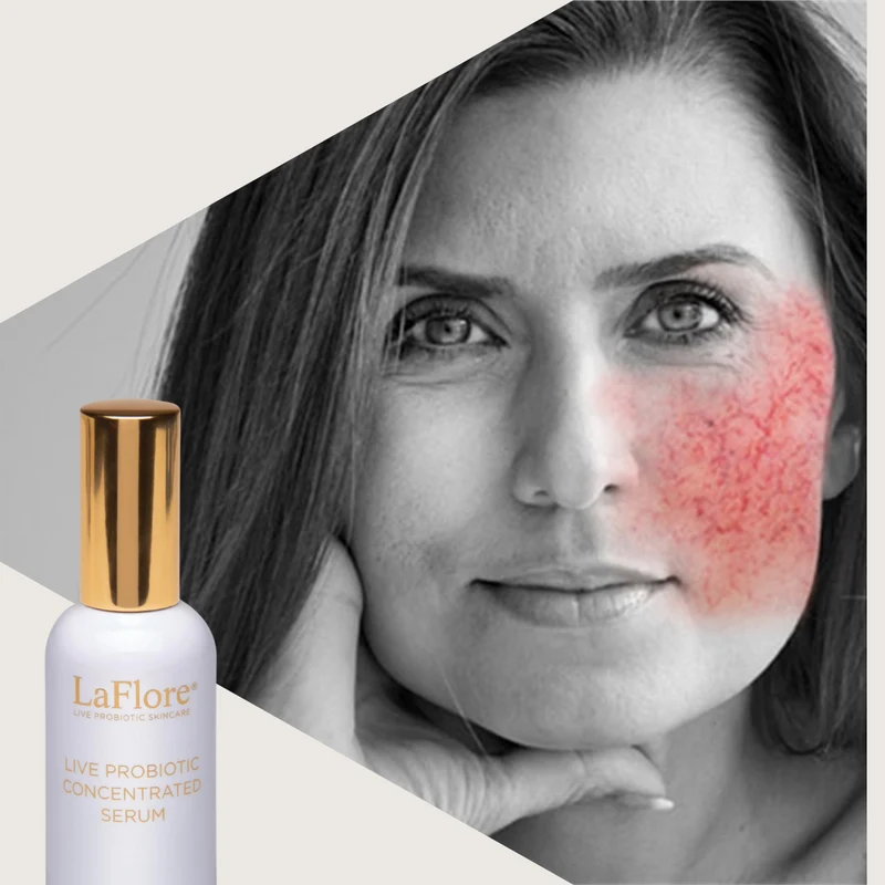 LaFlore Live Probiotic Concentrated Serum
